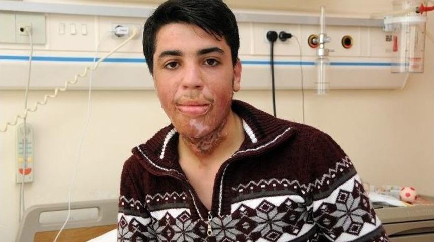 Bombalı Saldırıda Boynu Yanan Gen&ccedil;, Antalya&rsquo;da Sağlığına Kavuştu