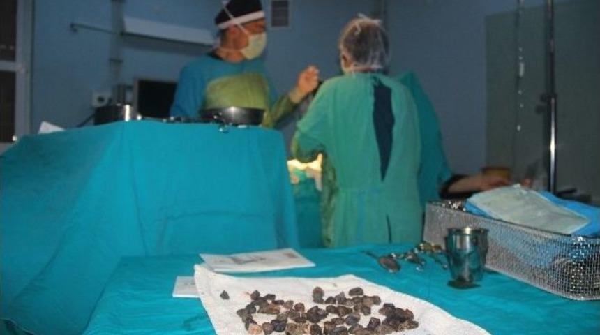 Mide Değil Taş Ocağı