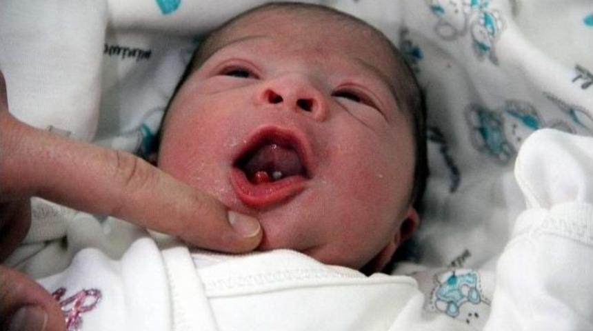 Nevşehir&rsquo;de Mira&ccedil; Bebek İki Dişli D&uuml;nyaya Geldi