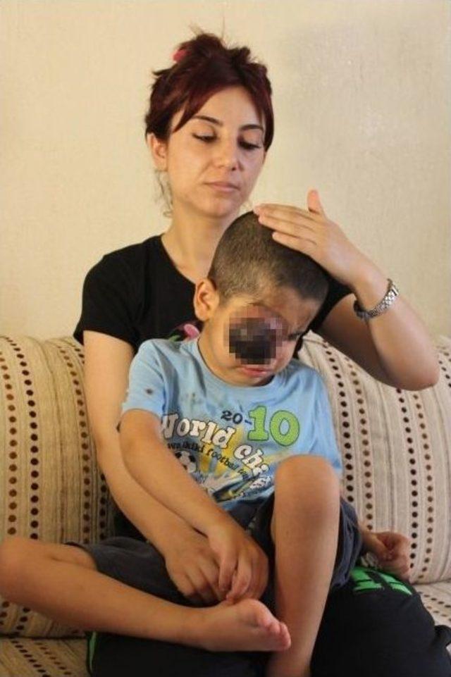 (&ouml;zel) T&uuml;m&ouml;rlerden Kurtuldu, Kanserden Kurtulamadı 3