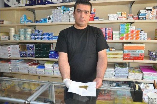 Safra Kesesinden 200 Taş &Ccedil;ıktı 1