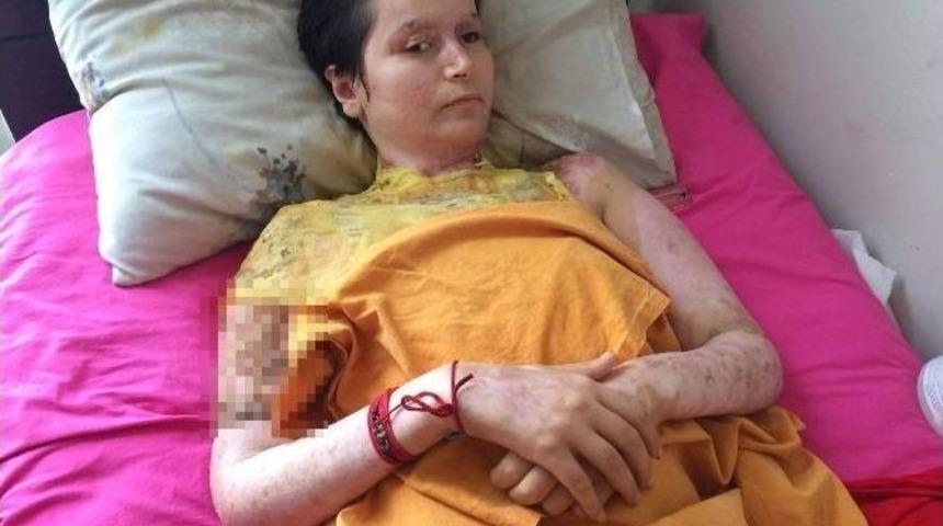 Kezzapla Yakılan Kadın, &Ccedil;ocuklarına Sarılmak İstiyor