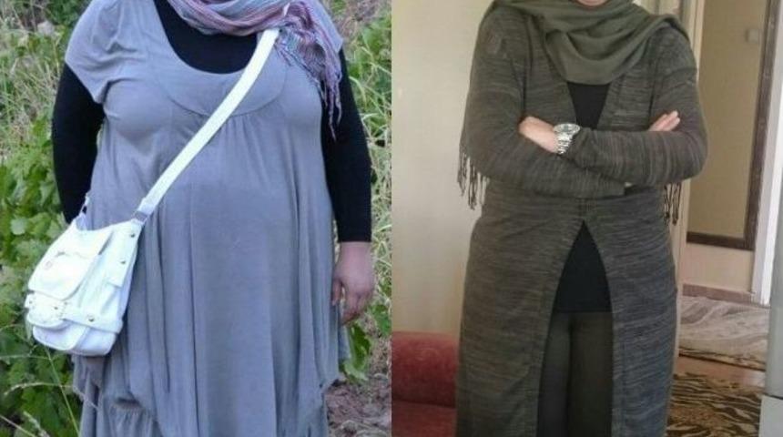 T&uuml;p Mide Ameliyatı İle Hayatları Değişti