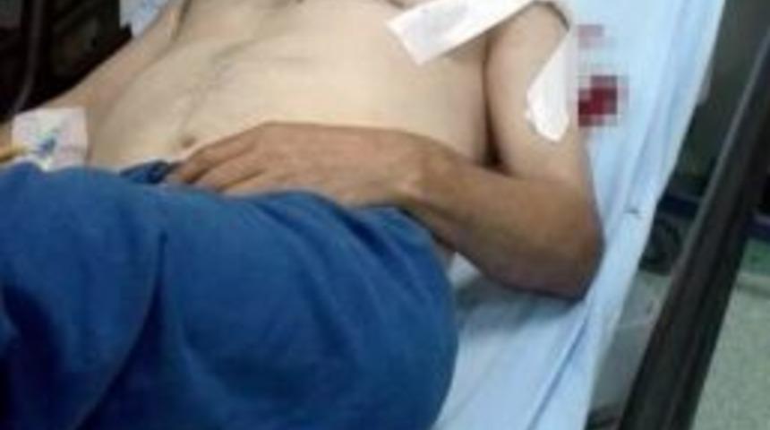 Odun Keserken Kendini Kesti