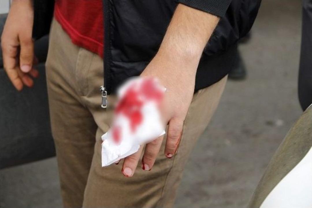 Ş&uuml;pheli &Ccedil;&ouml;p İncelemesi Yapan Polise Bı&ccedil;aklı Saldırı