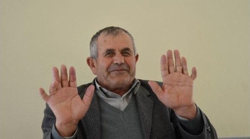 24 Parmağıyla Herkesi Şaşırtıyor