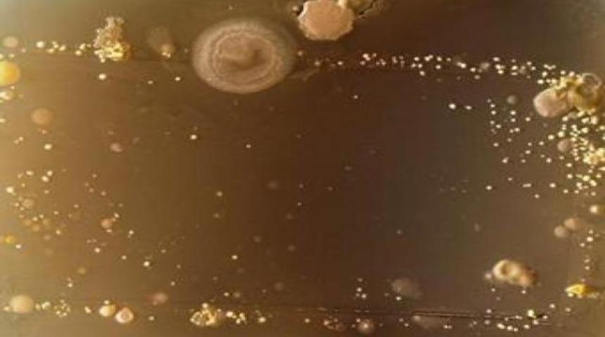 Avucunuzun i&ccedil;indeki gizli tehlike