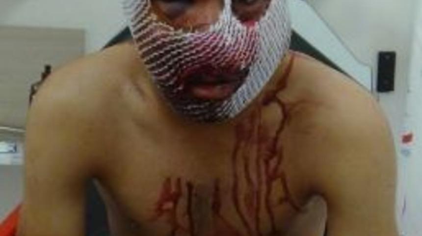 Işid&rsquo;in Saldırısında Yaralanan 1 Kişi Hayatını Kaybetti