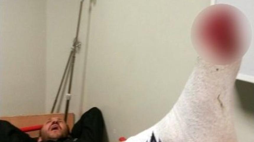 Tartıştığı Kişiyi Ayağından Vurdu