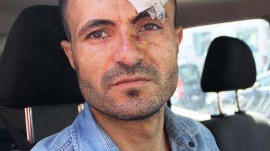 Yaralı Gen&ccedil; Dehşeti Anlattı