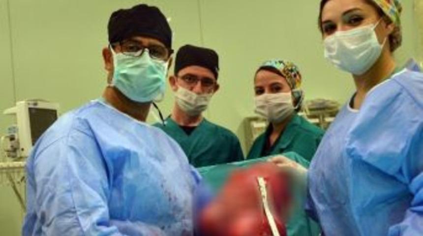 Karın Şişliğinden Gitti, Rahminde 4.5 Kilo Ur &Ccedil;ıktı