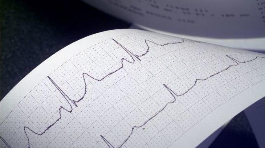 Kalp Hastalarına Oru&ccedil; Tavsiyeleri
