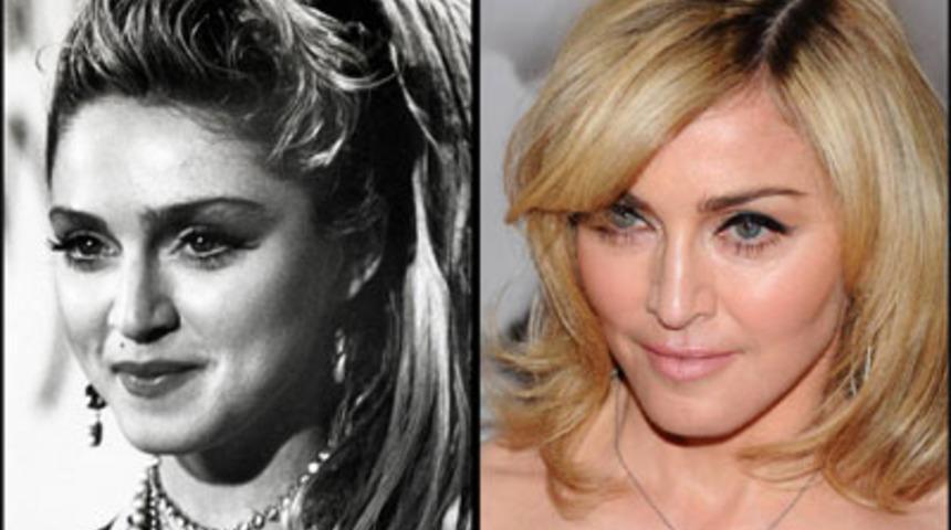 Estetikten &Ouml;nce ve Sonra &Uuml;nl&uuml;ler