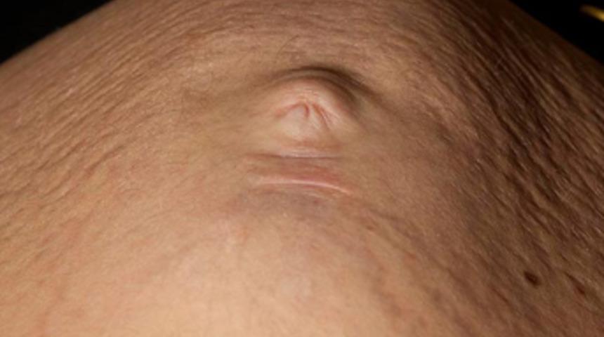 Karnına bakınca şok ge&ccedil;irdi