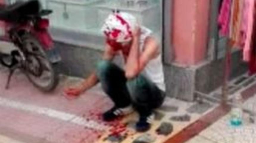 Kardeş Davulcuların Yer Kavgası Kanlı Bitti