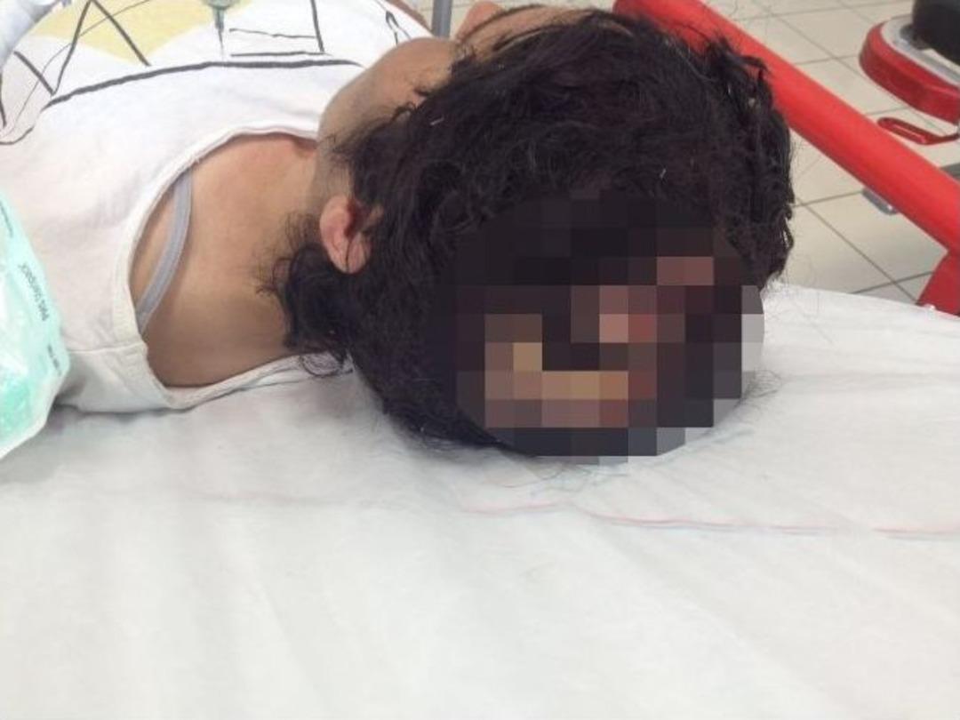 Eşini Ağaca Bağlayıp, Penseyle Tırnaklarını &Ccedil;ektiği İddiası