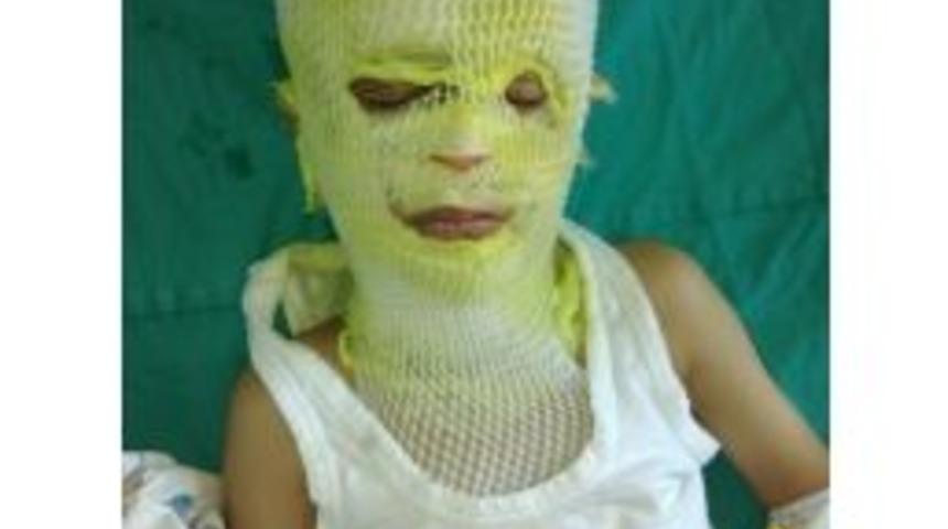 &Ccedil;atapat Ve Barutlu Mantar Karışımı Bu Hale Getirdi