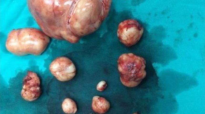 Rahminden 12 Adet Ur &Ccedil;ıktı