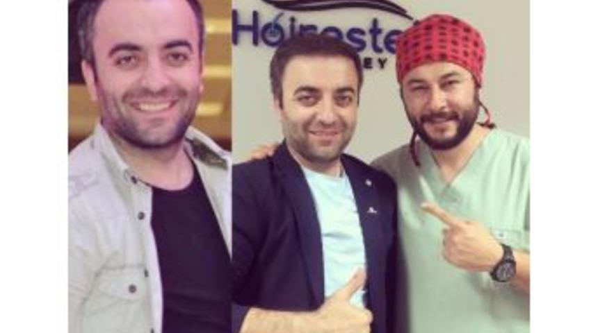 Kel Başa Şimşir Tarak Deyimi Bu Sayede Değişiyor