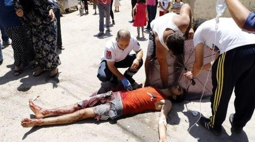 Uyuşturucu Bağımlısı Suriyeli Kardeş Kanı D&ouml;kt&uuml;: 2 Yaralı