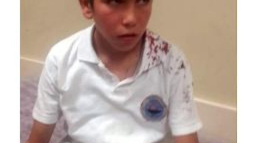 Suriyeli Çocuğun Tabureyle Dövüldüğü İddiası