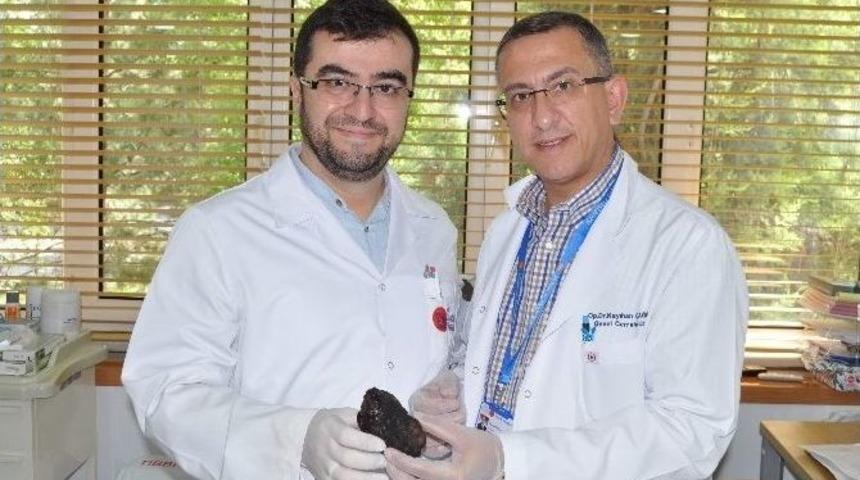 16 Yaşındaki Kızın Midesinden 190 Gram Taş &Ccedil;ıktı