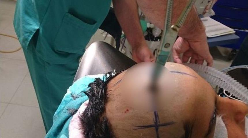 Kafasına Saplanan Makas, Yapılan Başarılı Ameliyatla &Ccedil;ıkarıldı