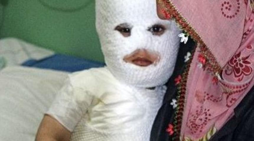 S&uuml;t Kazanına D&uuml;şen &Ccedil;ocuk Feci Şekilde Yandı