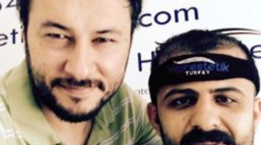 Kadınların Daha Az Sa&ccedil;ı D&ouml;k&uuml;l&uuml;yor