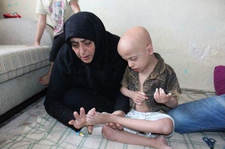 Suriyeli Çocuğun İyileşmeyen Hastalığı G2