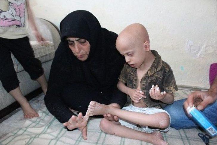 Suriyeli Çocuğun İyileşmeyen Hastalığı G3