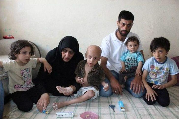 Suriyeli Çocuğun İyileşmeyen Hastalığı G4