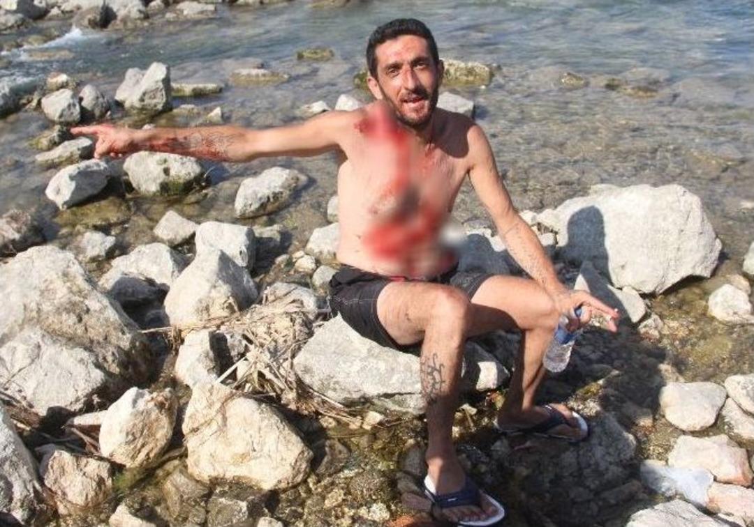 Eşi Boşanınca Jiletle Kendini Doğradı