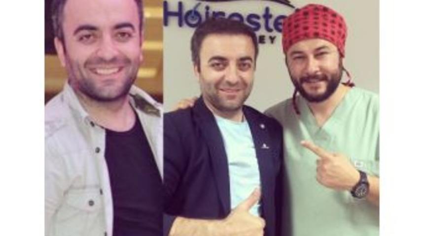 Sa&ccedil; Ekiminde Tepe Kısma Dikkat