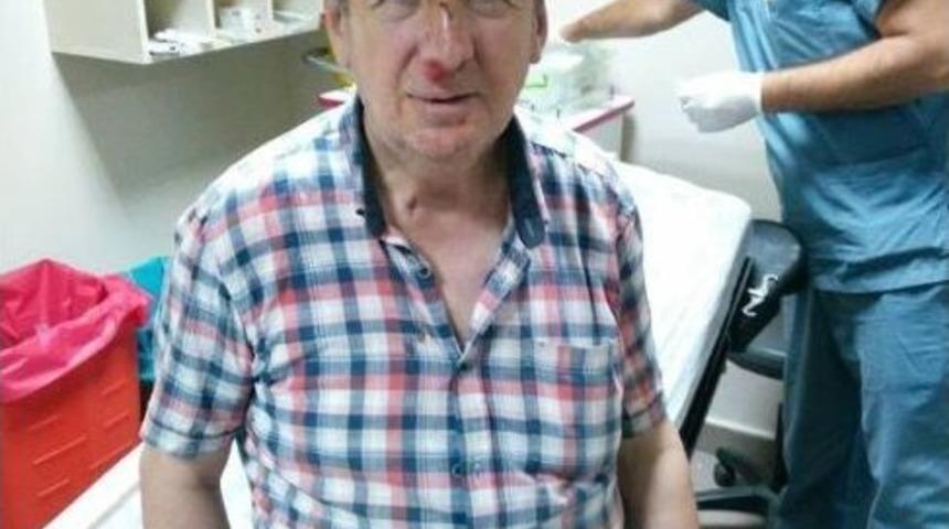 Bolu&rsquo;da Gazeteciye Yumruklu Saldırı