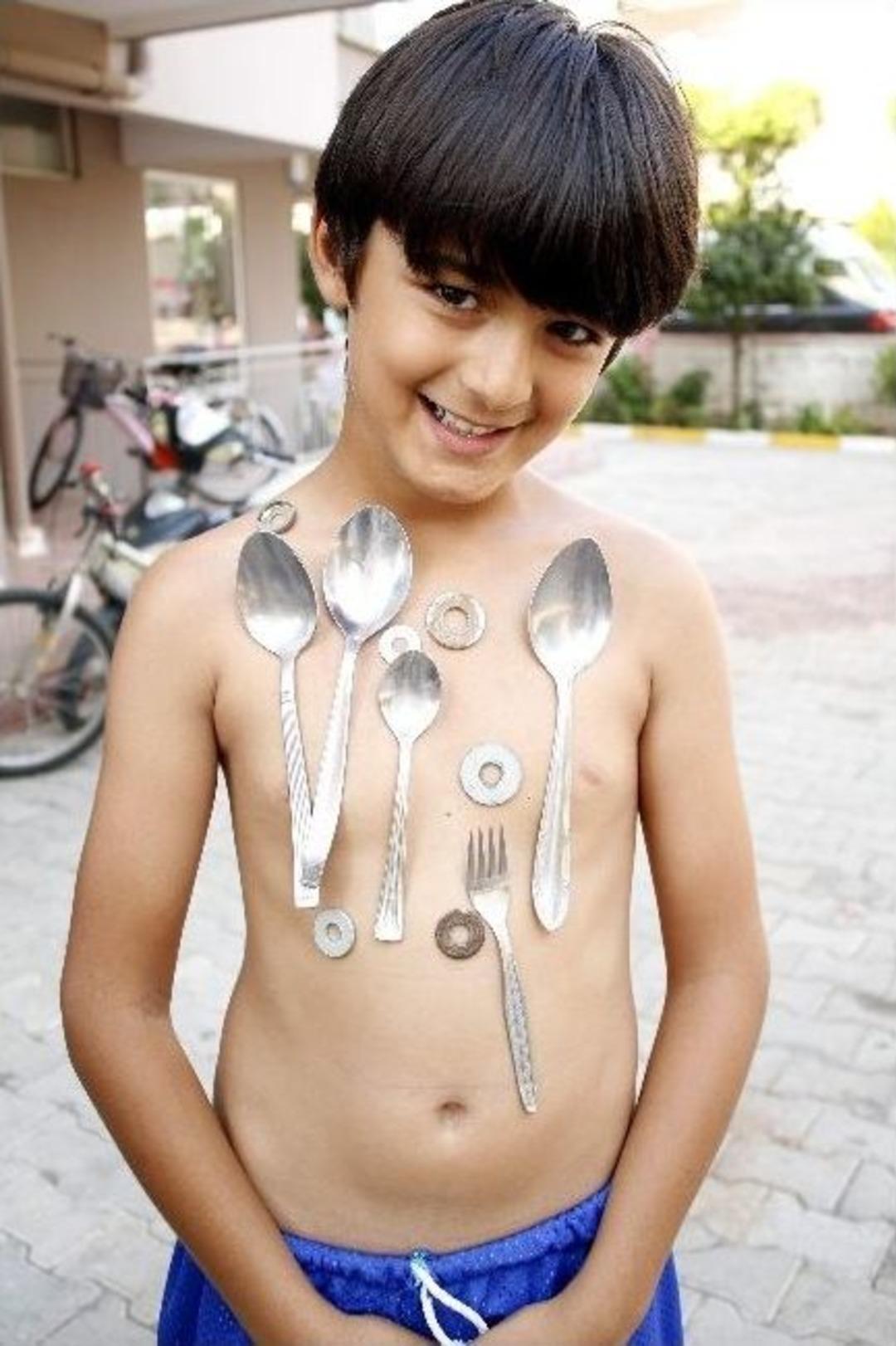 (&ouml;zel Haber) Antalya&rsquo;da 9 Yaşındaki &Ccedil;ocuğun V&uuml;cudu Mıknatıs Gibi