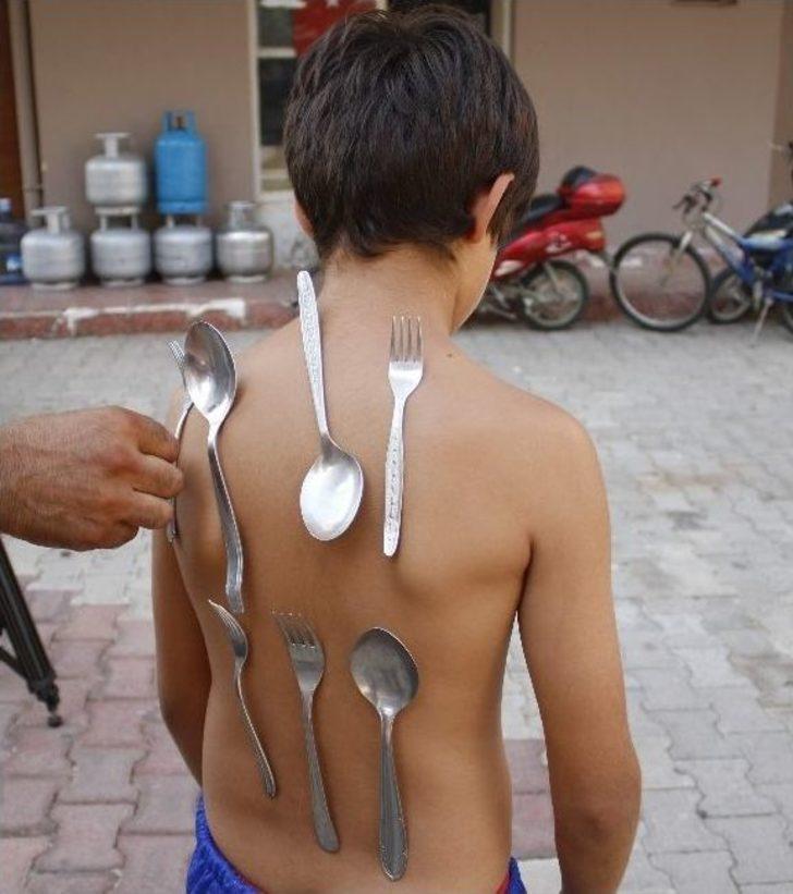 (özel Haber) Antalya’da 9 Yaşındaki Çocuğun Vücudu Mıknatıs Gibi G2