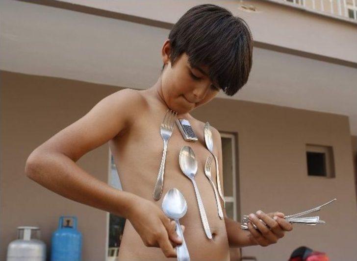 (özel Haber) Antalya’da 9 Yaşındaki Çocuğun Vücudu Mıknatıs Gibi G3