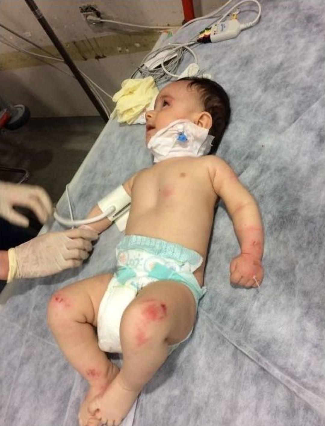 Havalandırma Boşluğuna Atılan Bebeğin Kurtarılma Anı Kamerada