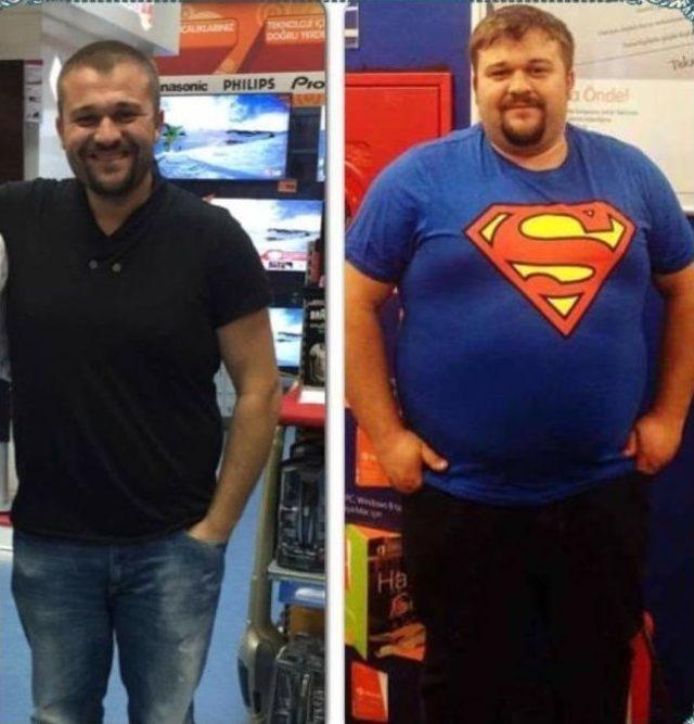 (özel Haber) Bir Yılda 80 Kilo Verdi Hayatı Değişti