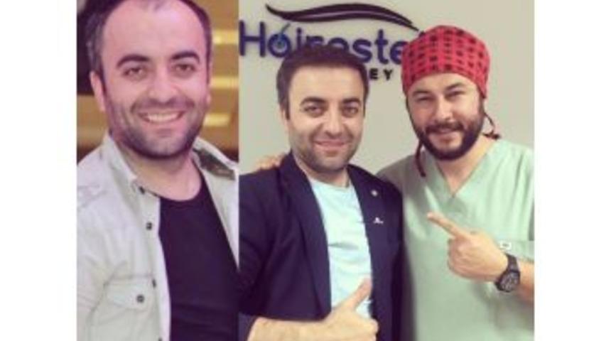 Sa&ccedil; Ekiminde İkinci Seans Şart