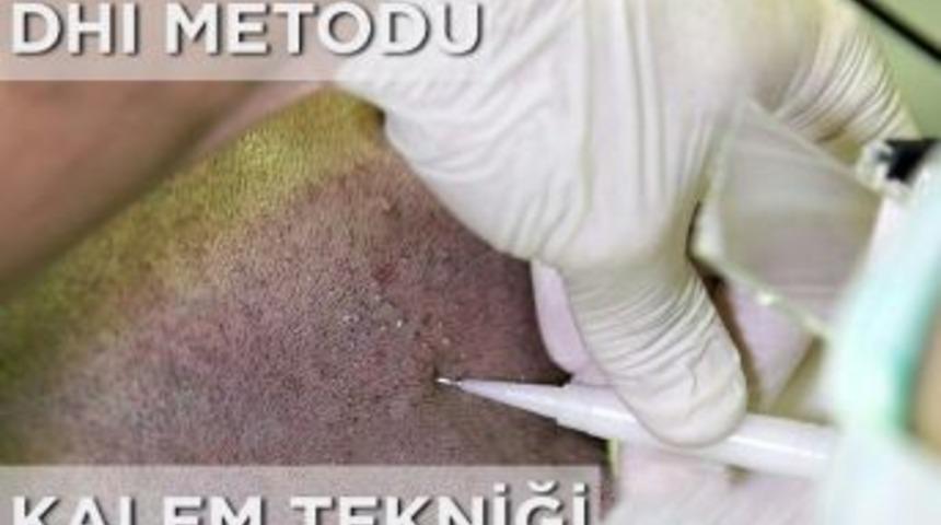 Daha Sık Sa&ccedil;lar İ&ccedil;in Kalem Tekniği