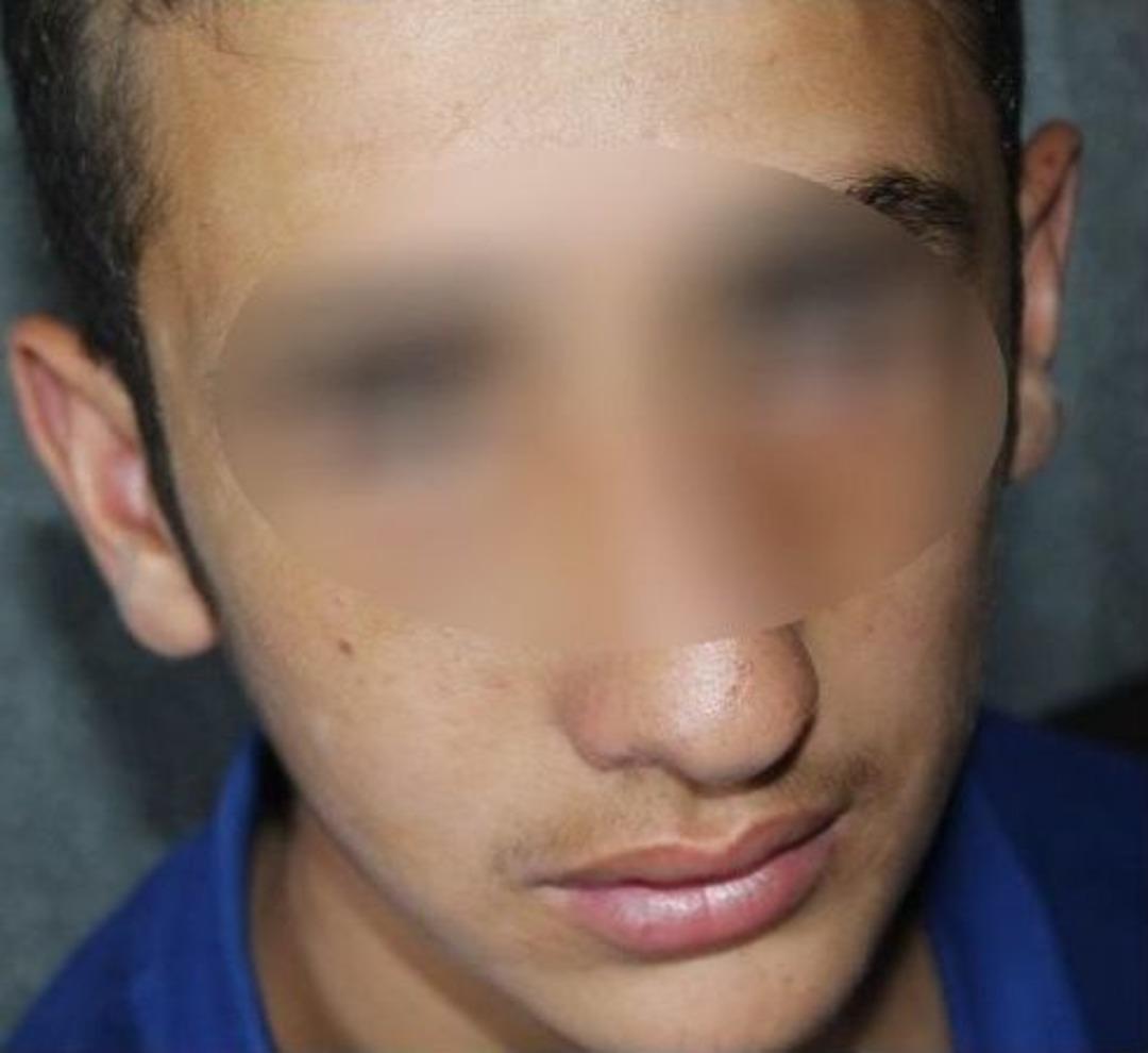 Ka&ccedil;ırılan 13 Yaşındaki &Ccedil;ocuğa Darp