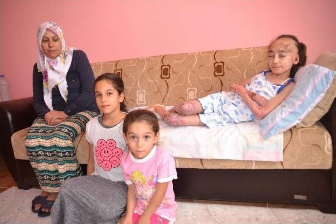 (&ouml;zel Haber) Epidermolizis B&uuml;lloza Hastası Merve Yardım Bekliyor