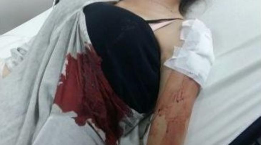 &Ccedil;akmakla Isıttığı Mermi Patladı, Suriyeli Gen&ccedil; Kız Yaralandı