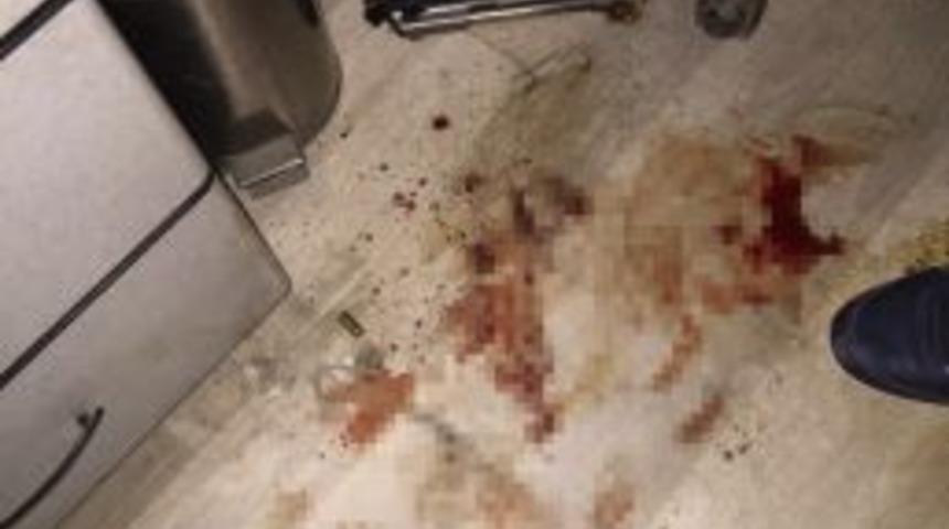 Diyarbakır&rsquo;da Ailesiyle Tartışan Gen&ccedil; Kendini Silahla Vurdu