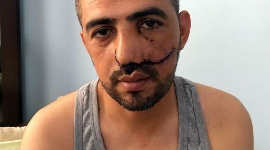 (&ouml;zel Haber) Boğazi&ccedil;i K&ouml;pr&uuml;s&uuml;&rsquo;nde Yaralanan Hamit Hakan Yılmazt&uuml;rk, O Anları Anlattı: