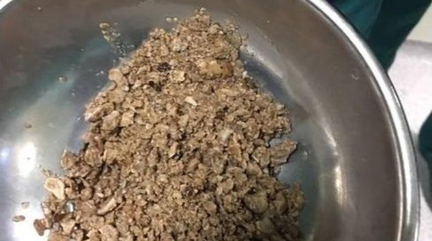 B&ouml;brek Değil Taş Ocağı