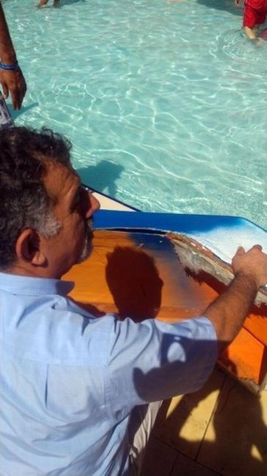 5 Yıldızlı Otelin Kaydırağı 8 Yaşındaki &Ccedil;ocuğun Parmağını Kopardı