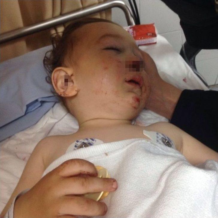 Ankara’da 16 Aylık Bebek 3. Kattan Merdiven Boşluğuna Düştü